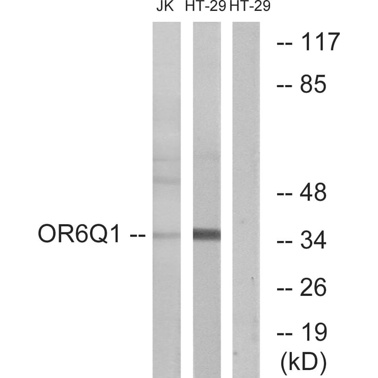 Western Blot - Anti-OR6Q1 Antibody (G669) - Antibodies.com