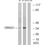 Western Blot - Anti-OR6Q1 Antibody (G669) - Antibodies.com