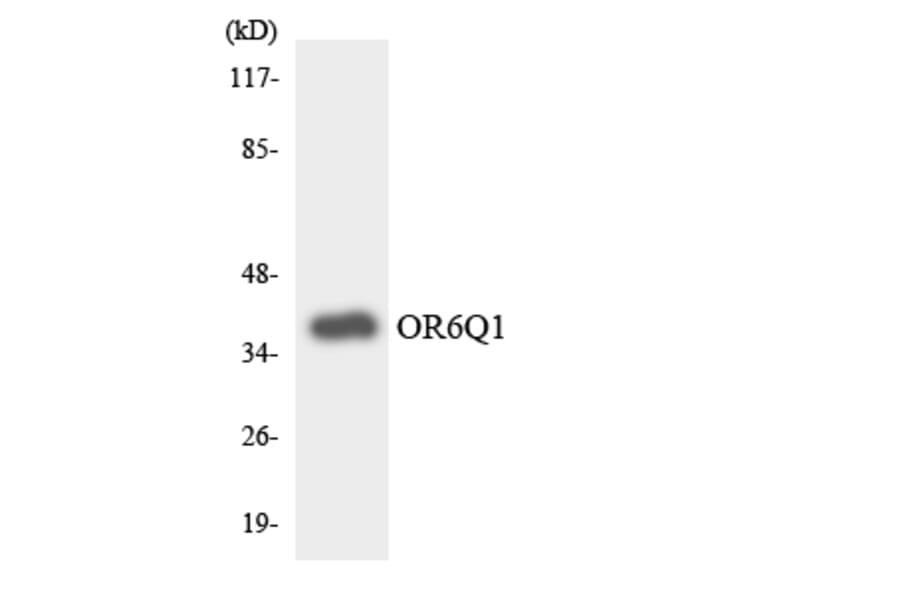 Western Blot - Anti-OR6Q1 Antibody (R12-3255) - Antibodies.com