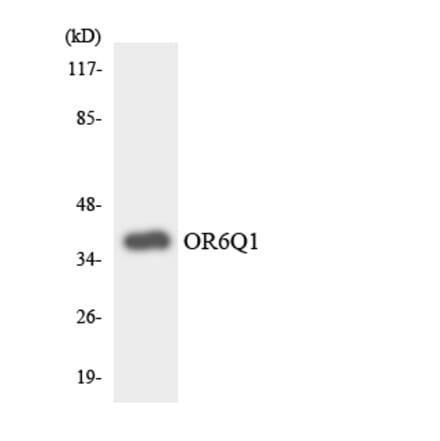 Western Blot - Anti-OR6Q1 Antibody (R12-3255) - Antibodies.com