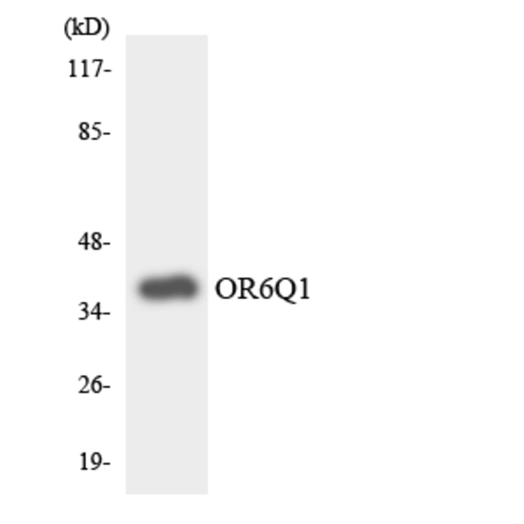 Western Blot - Anti-OR6Q1 Antibody (R12-3255) - Antibodies.com