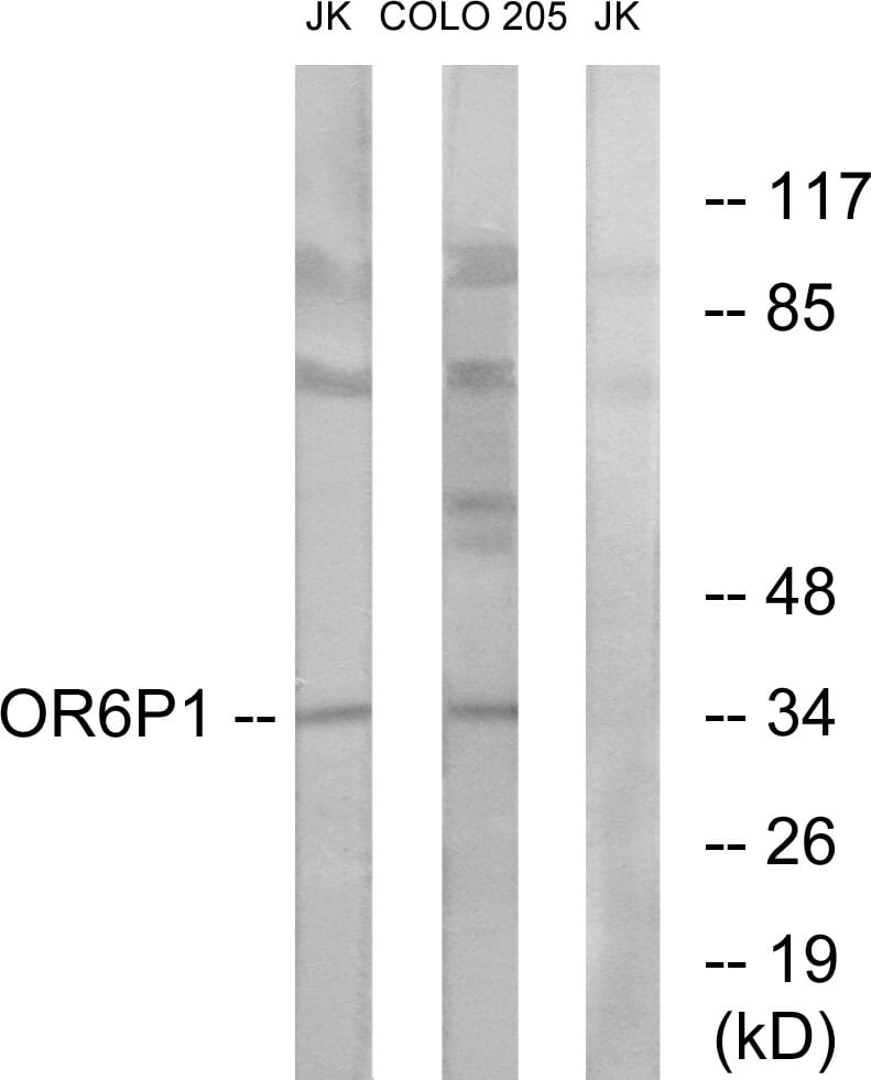 Western blot analysis of lysates from Jurkat and COLO cells using Anti-OR6P1 Antibody. The right hand lane represents a negative control, where the antibody is blocked by the immunising peptide.
