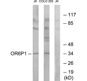 Western Blot - Anti-OR6P1 Antibody (G668) - Antibodies.com