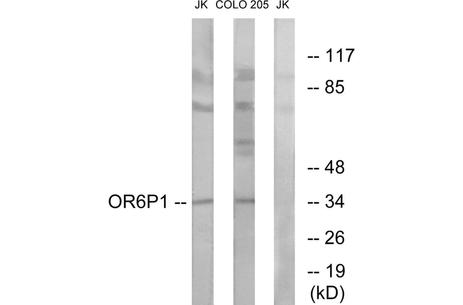 Western Blot - Anti-OR6P1 Antibody (G668) - Antibodies.com