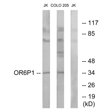 Western Blot - Anti-OR6P1 Antibody (G668) - Antibodies.com