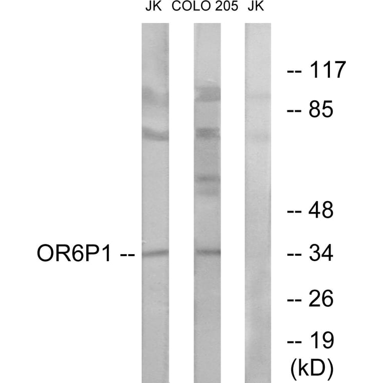 Western Blot - Anti-OR6P1 Antibody (G668) - Antibodies.com
