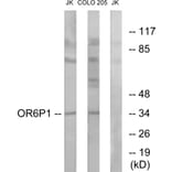 Western Blot - Anti-OR6P1 Antibody (G668) - Antibodies.com