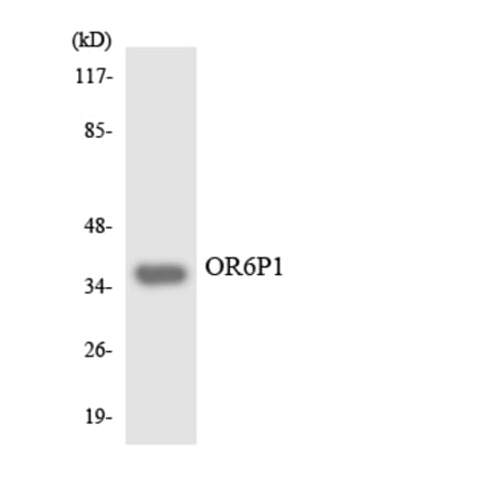 Western Blot - Anti-OR6P1 Antibody (R12-3254) - Antibodies.com