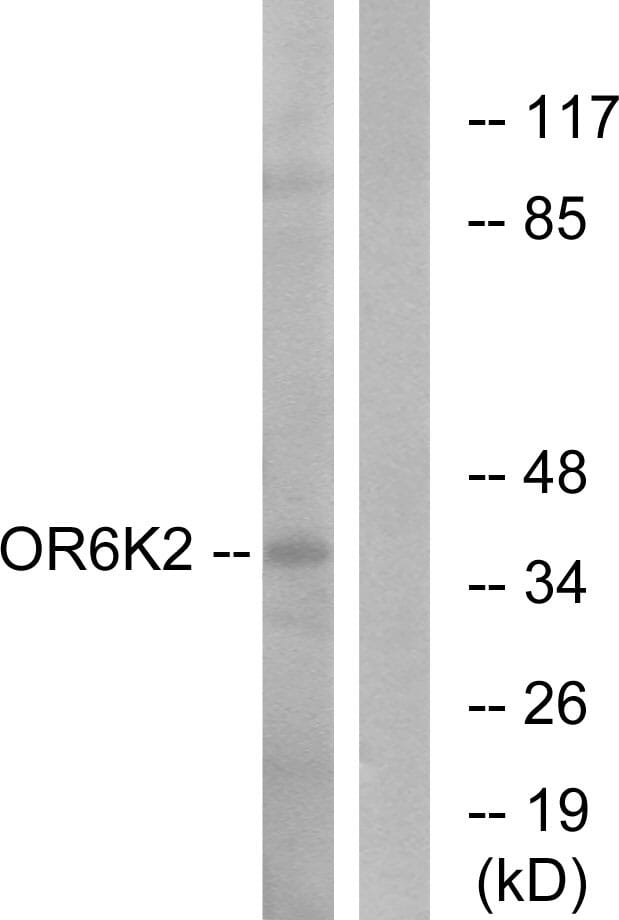 Western blot analysis of lysates from HeLa cells using Anti-OR6K2 Antibody. The right hand lane represents a negative control, where the antibody is blocked by the immunising peptide.