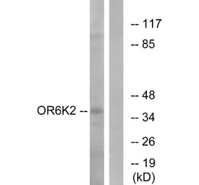 Western Blot - Anti-OR6K2 Antibody (G663) - Antibodies.com