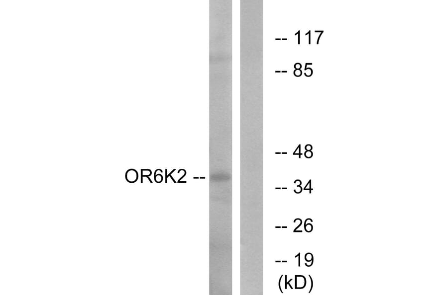 Western Blot - Anti-OR6K2 Antibody (G663) - Antibodies.com