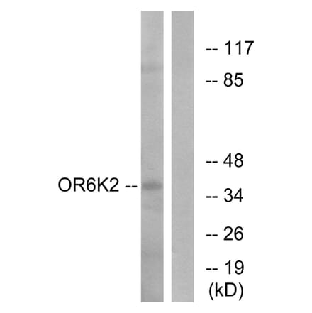 Western Blot - Anti-OR6K2 Antibody (G663) - Antibodies.com