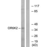 Western Blot - Anti-OR6K2 Antibody (G663) - Antibodies.com