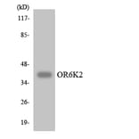 Western Blot - Anti-OR6K2 Antibody (R12-3253) - Antibodies.com