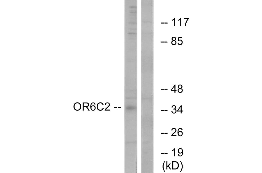 Western Blot - Anti-OR6C2 Antibody (G661) - Antibodies.com