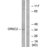 Western Blot - Anti-OR6C2 Antibody (G661) - Antibodies.com