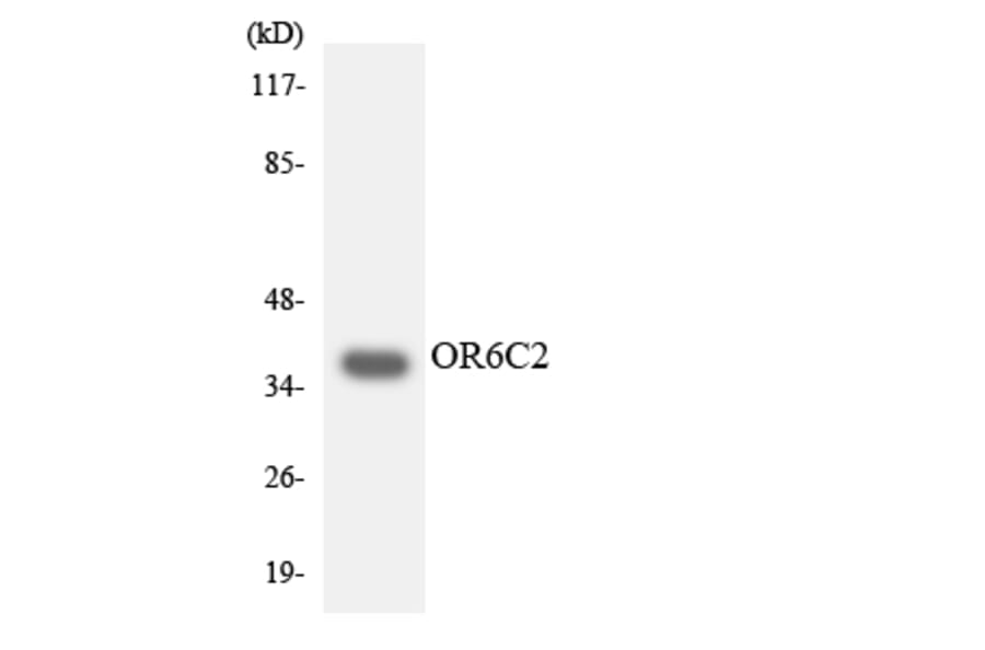 Western Blot - Anti-OR6C2 Antibody (R12-3248) - Antibodies.com
