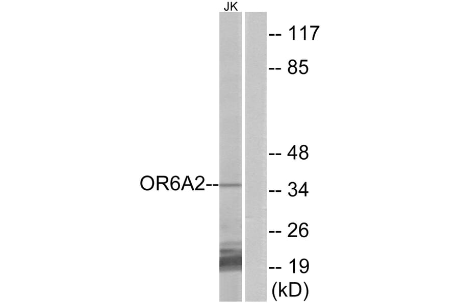 Western Blot - Anti-OR6A2 Antibody (G658) - Antibodies.com