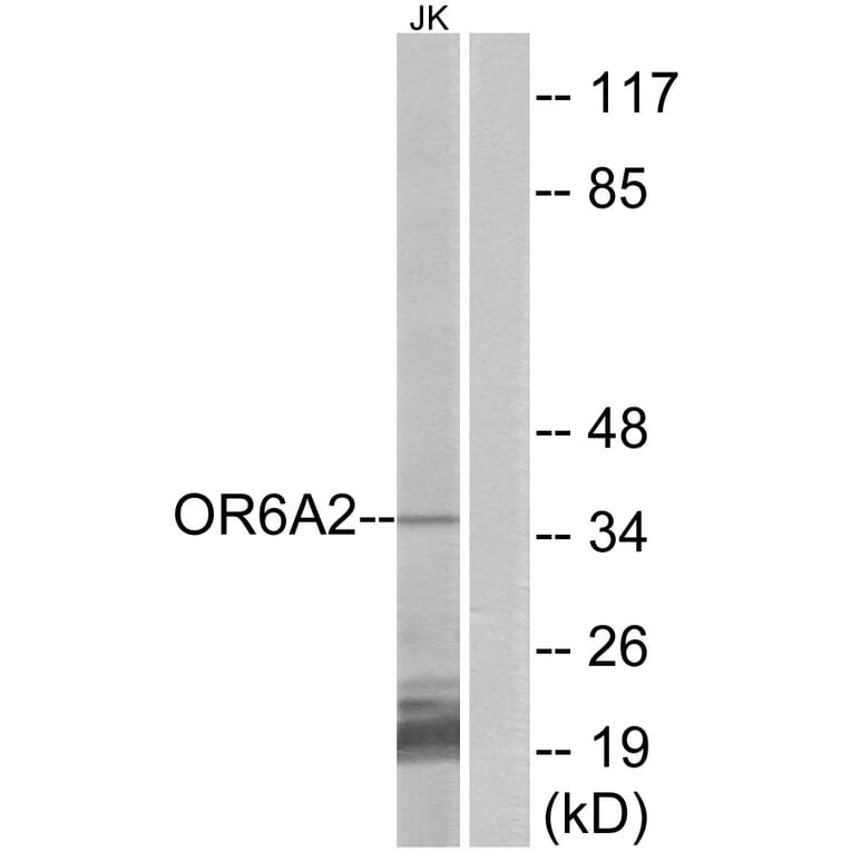 Western Blot - Anti-OR6A2 Antibody (G658) - Antibodies.com