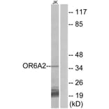 Western Blot - Anti-OR6A2 Antibody (G658) - Antibodies.com
