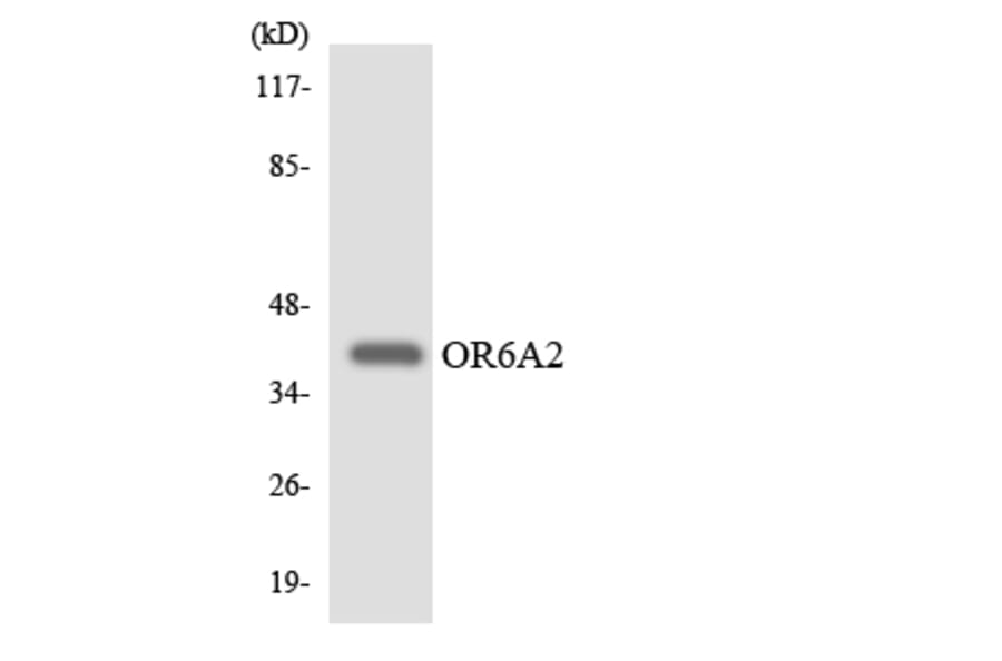 Western Blot - Anti-OR6A2 Antibody (R12-3247) - Antibodies.com
