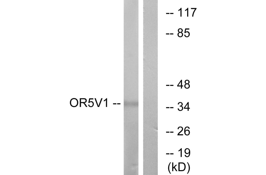 Western Blot - Anti-OR5V1 Antibody (G656) - Antibodies.com