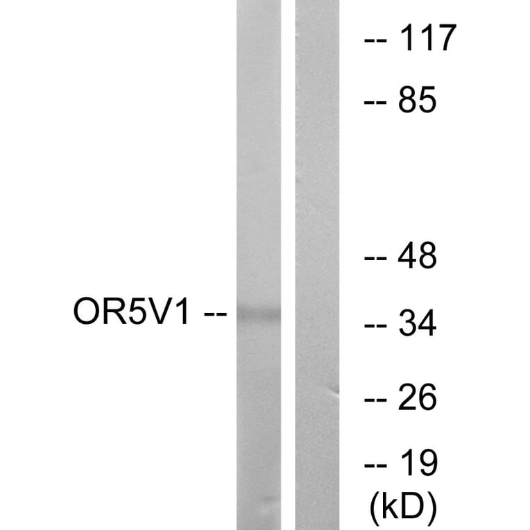 Western Blot - Anti-OR5V1 Antibody (G656) - Antibodies.com