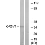 Western Blot - Anti-OR5V1 Antibody (G656) - Antibodies.com