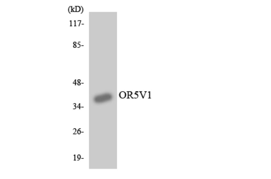 Western Blot - Anti-OR5V1 Antibody (R12-3245) - Antibodies.com