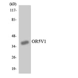 Western Blot - Anti-OR5V1 Antibody (R12-3245) - Antibodies.com