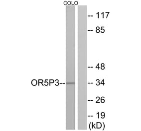 Western Blot - Anti-OR5P3 Antibody (G652) - Antibodies.com