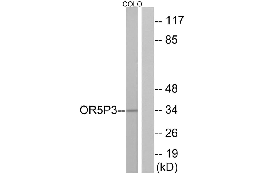 Western Blot - Anti-OR5P3 Antibody (G652) - Antibodies.com