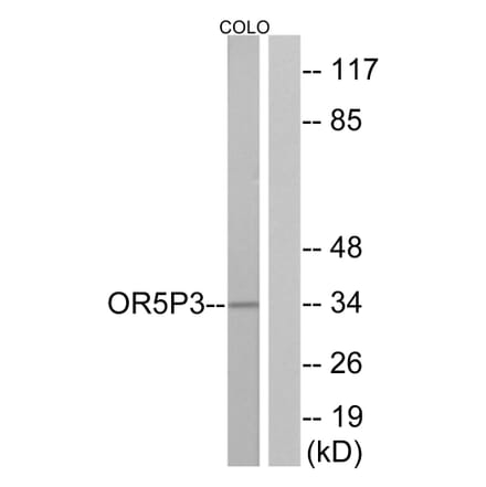 Western Blot - Anti-OR5P3 Antibody (G652) - Antibodies.com