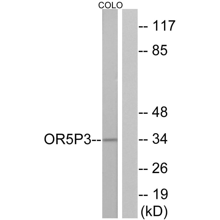 Western Blot - Anti-OR5P3 Antibody (G652) - Antibodies.com