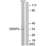 Western Blot - Anti-OR5P3 Antibody (G652) - Antibodies.com