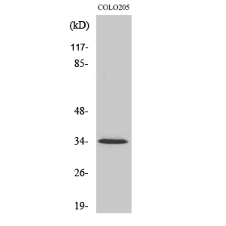 Western Blot - Anti-OR5P3 Antibody (G652) - Antibodies.com