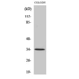 Western Blot - Anti-OR5P3 Antibody (G652) - Antibodies.com