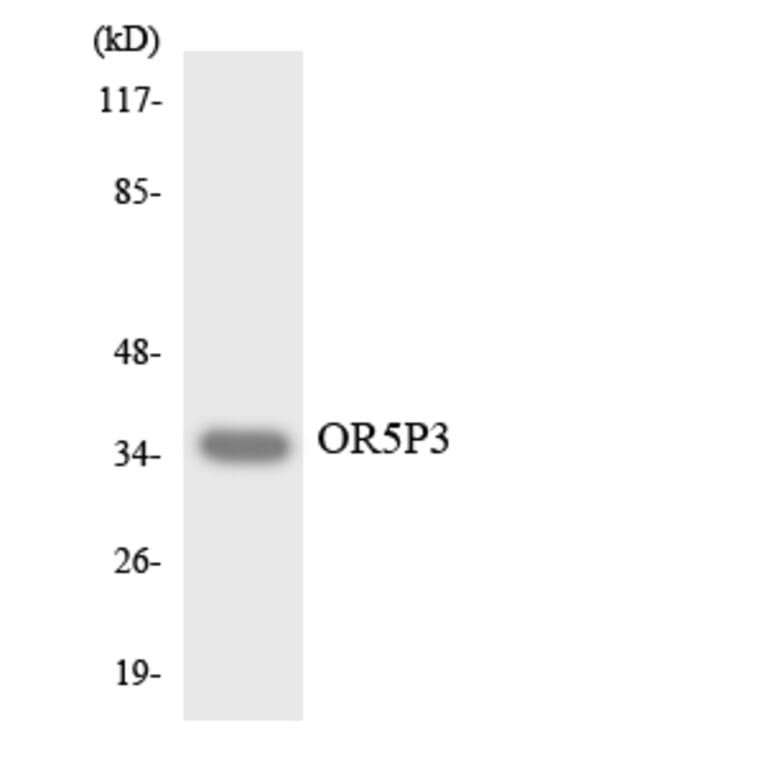 Western Blot - Anti-OR5P3 Antibody (R12-3244) - Antibodies.com