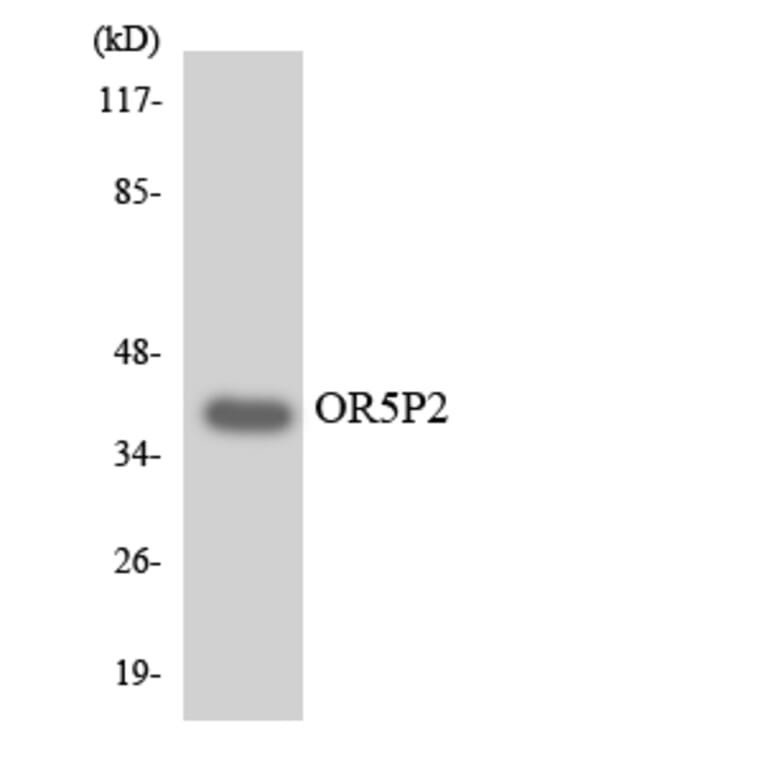 Western Blot - Anti-OR5P2 Antibody (R12-3243) - Antibodies.com