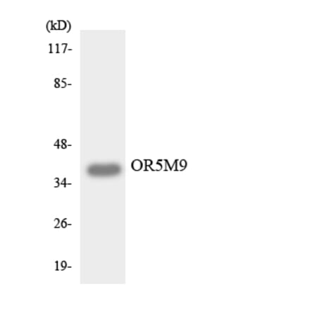 Western Blot - Anti-OR5M9 Antibody (R12-3242) - Antibodies.com