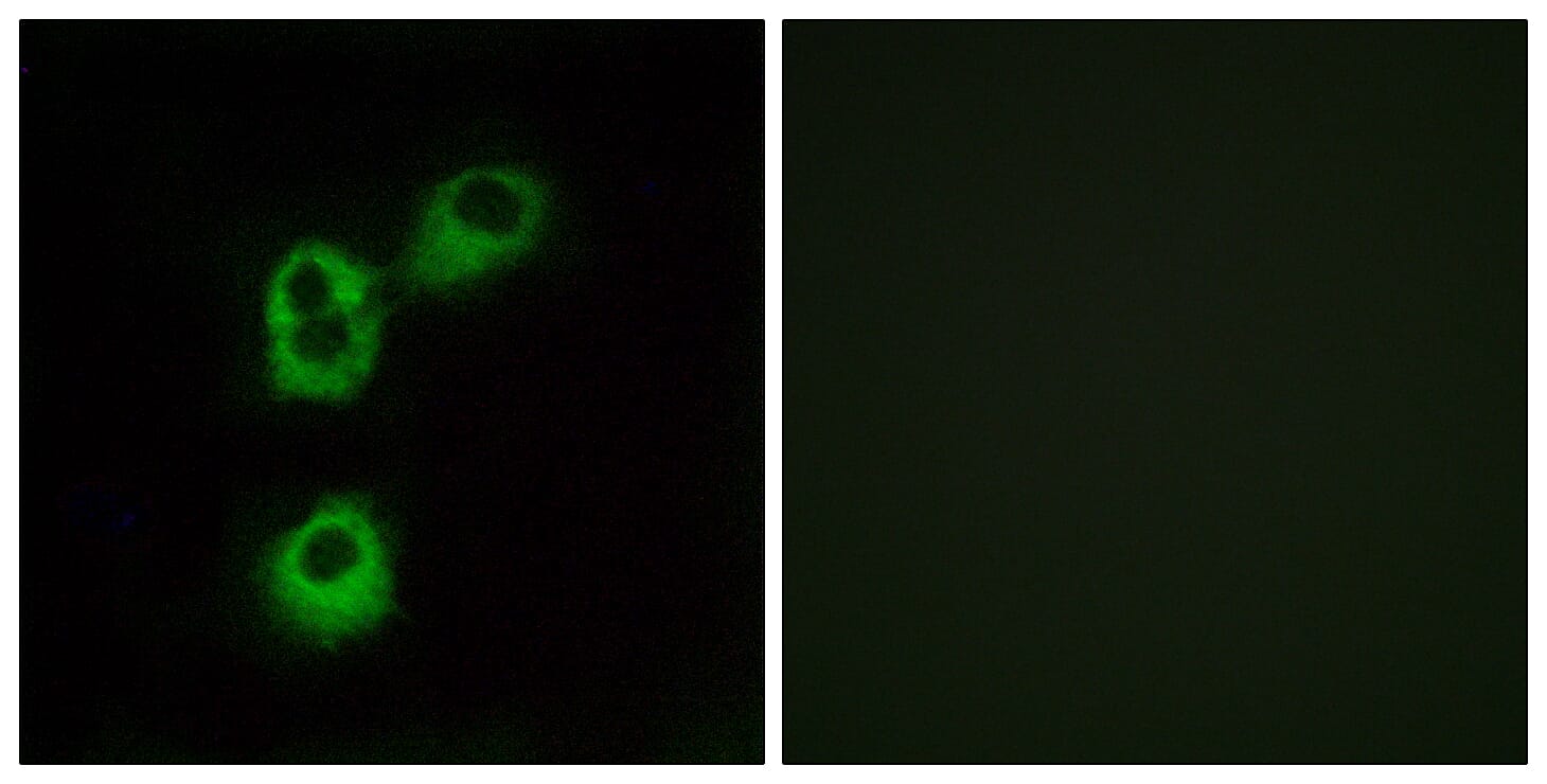 Immunofluorescence analysis of MCF7 cells using Anti-OR5M1 Antibody. The right hand panel represents a negative control, where the antibody was pre-incubated with the immunising peptide.