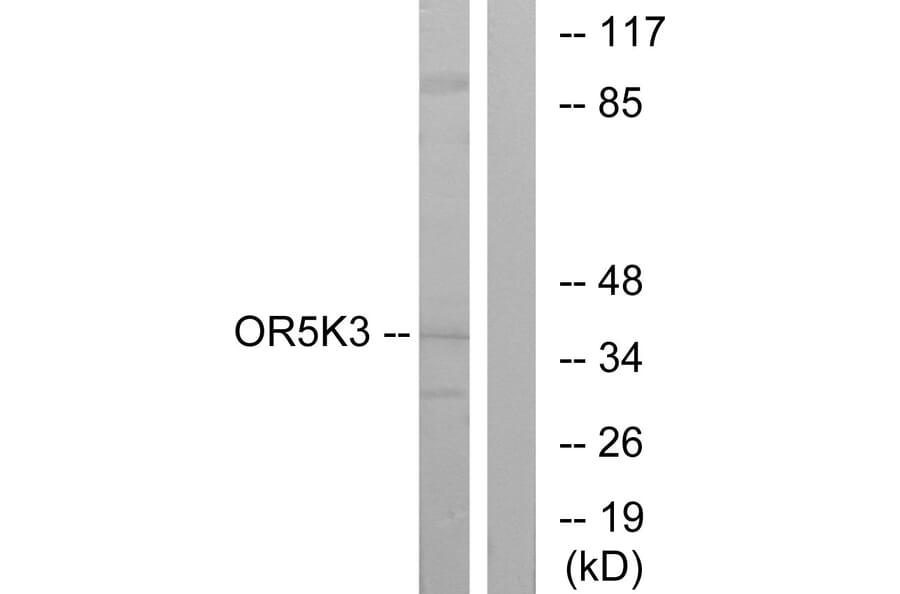 Western Blot - Anti-OR5K3 Antibody (G644) - Antibodies.com