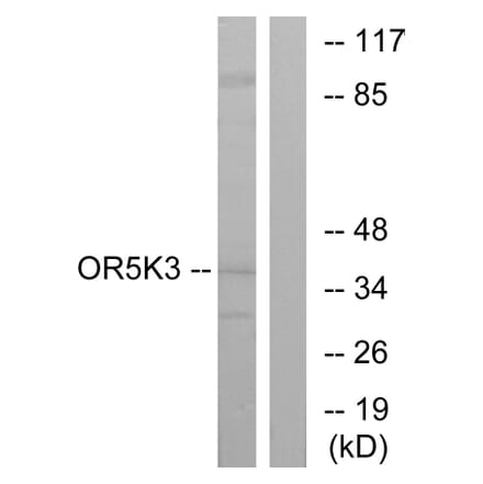 Western Blot - Anti-OR5K3 Antibody (G644) - Antibodies.com