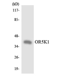 Western Blot - Anti-OR5K1 Antibody (R12-3237) - Antibodies.com