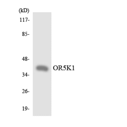 Western Blot - Anti-OR5K1 Antibody (R12-3237) - Antibodies.com