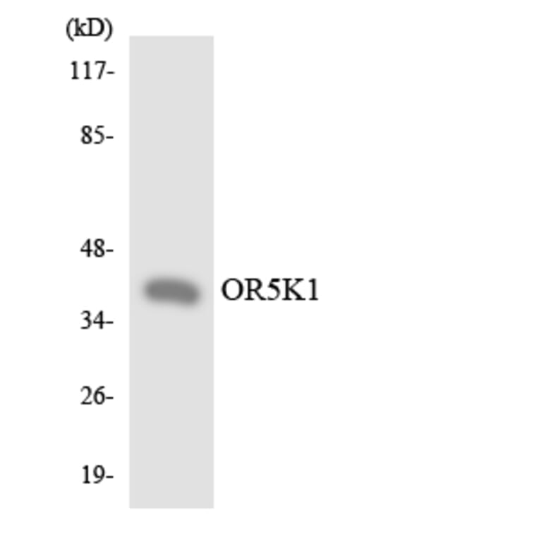 Western Blot - Anti-OR5K1 Antibody (R12-3237) - Antibodies.com