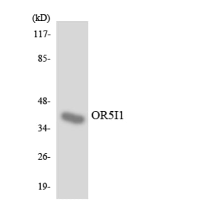 Western Blot - Anti-OR5I1 Antibody (R12-3236) - Antibodies.com