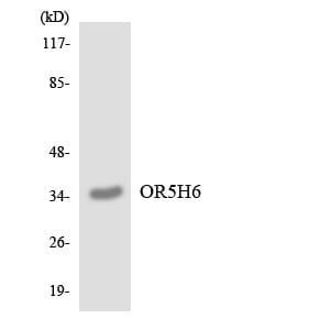 Western blot analysis of the lysates from COLO205 cells using Anti-OR5H6 Antibody.
