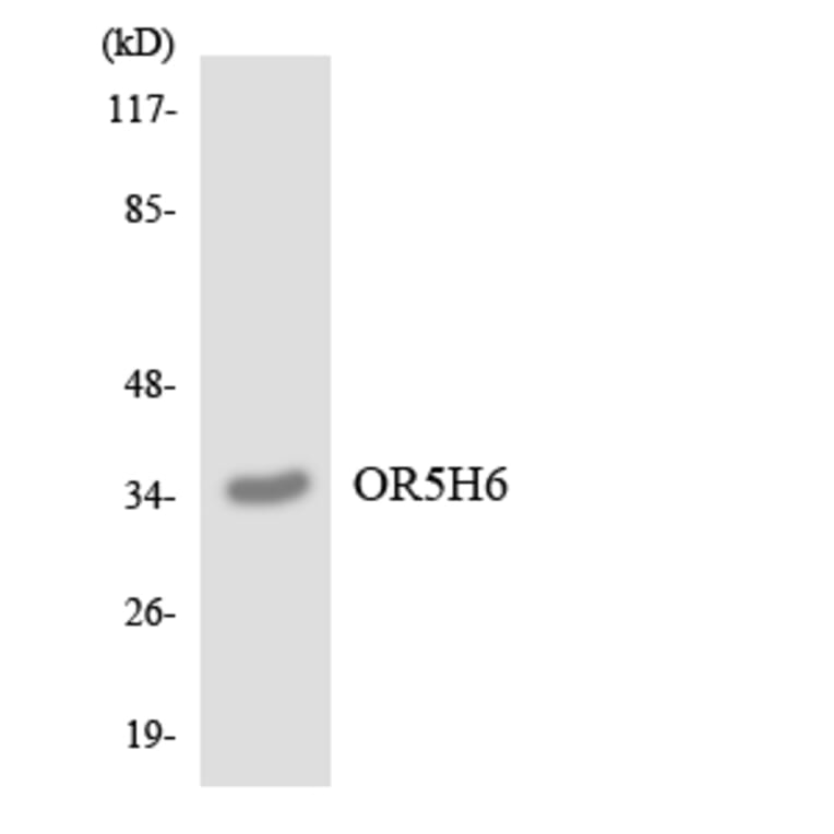 Western Blot - Anti-OR5H6 Antibody (R12-3235) - Antibodies.com