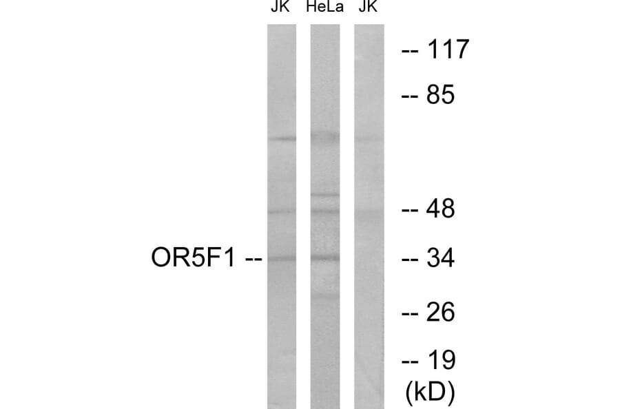 Western Blot - Anti-OR5F1 Antibody (G637) - Antibodies.com